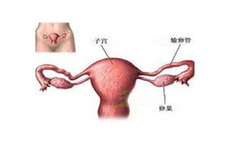 附件炎的具体表现