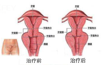 阴道有异味瘙痒究竟是怎么回事？